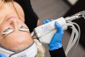 Halo laser, an example for best laser for face in dallas