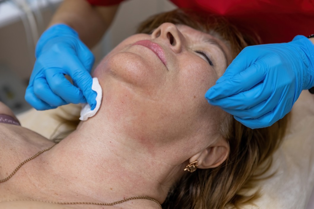 preparing a patient's neck for facial fillers in dallas