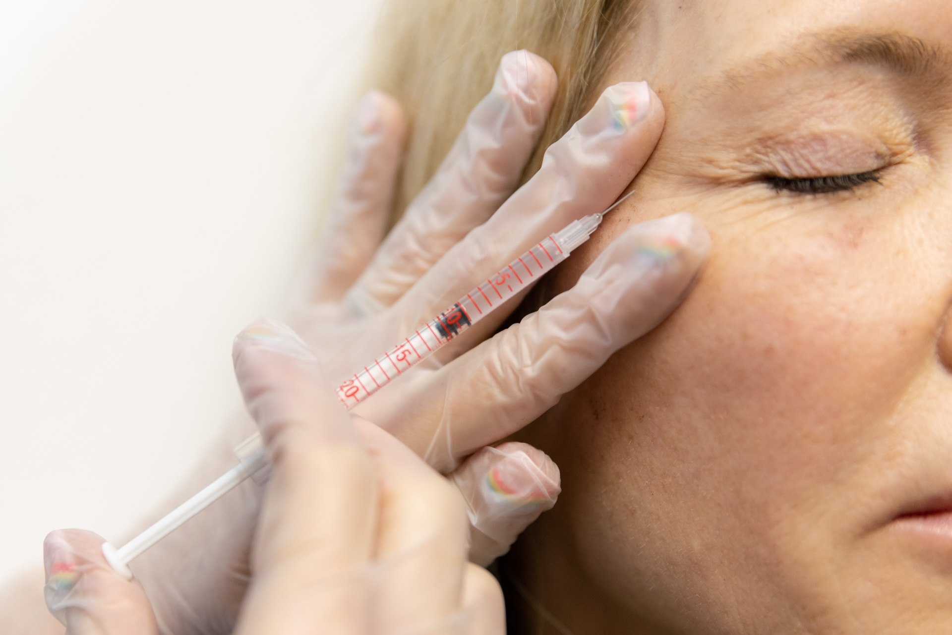 injector with gloves injecting Botox into patient's cheek