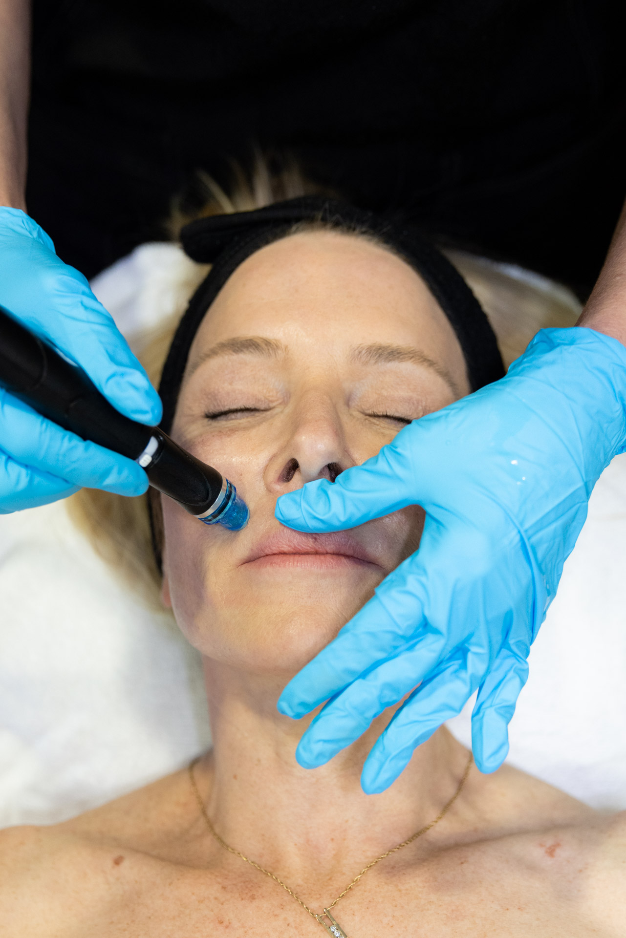 technician with blue gloves performing hydrafacial on a patient