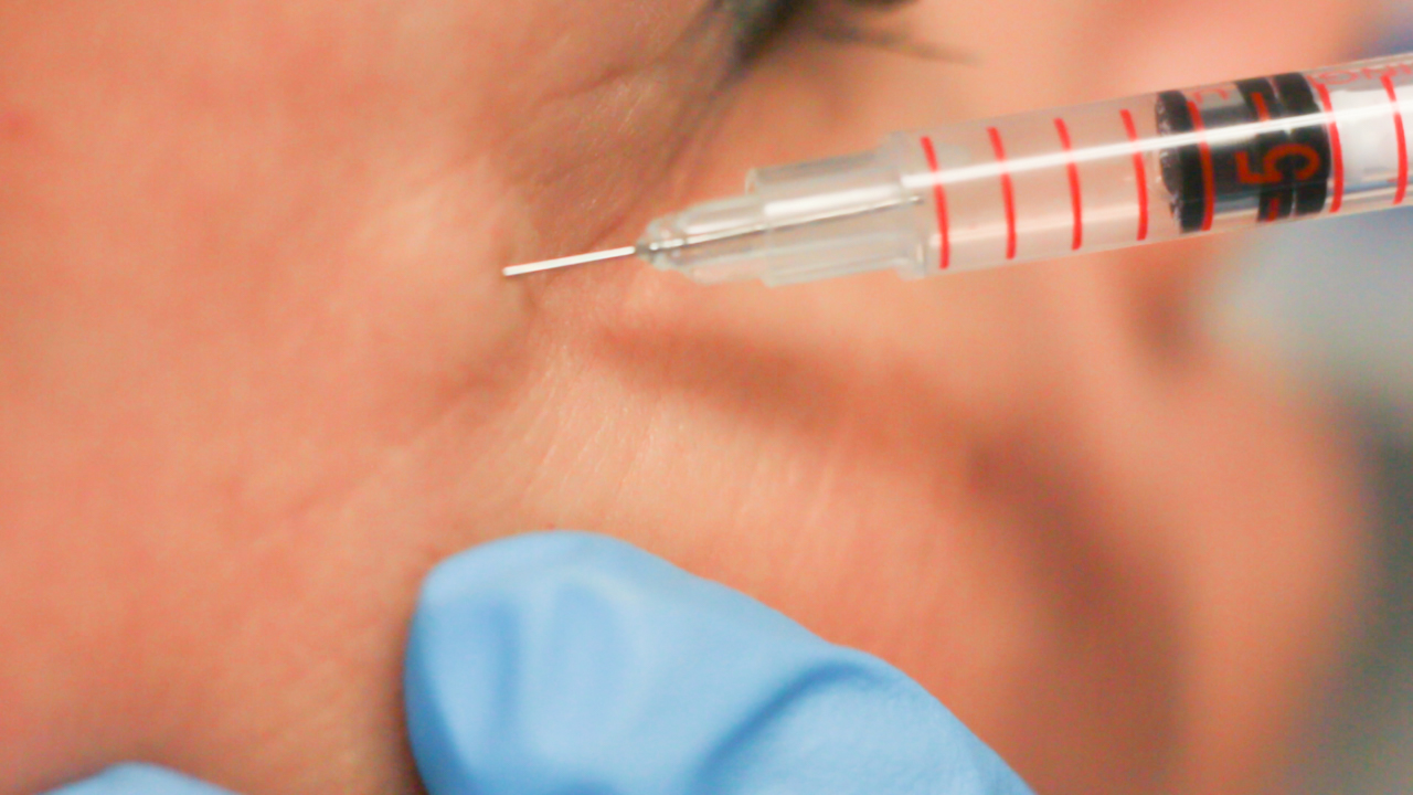 injecting Botox into patient's crow's feet