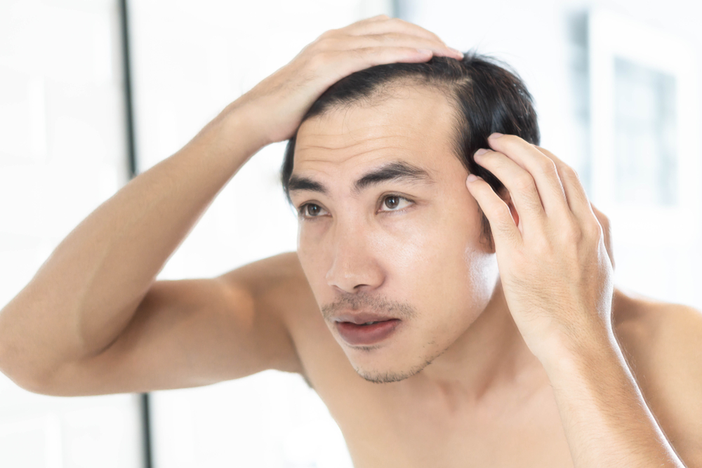 A man looking at his thinning hair in the mirror