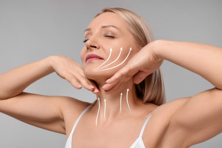 A woman lifting her chin after a neck lift in Southlake