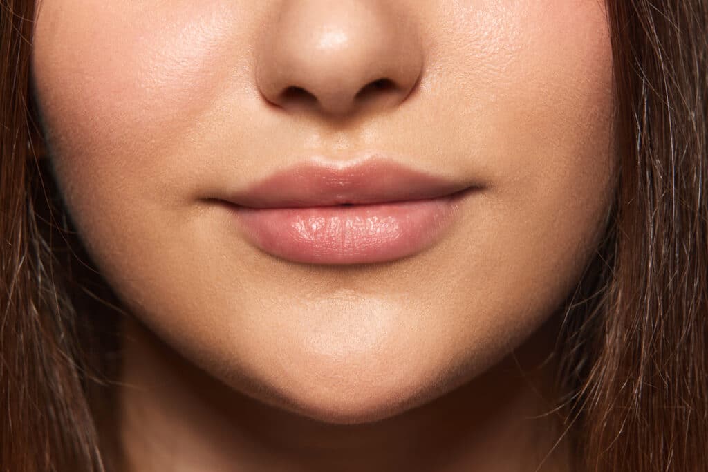 Natural-looking lip enhancement results after a lip lift or lip filler treatment.